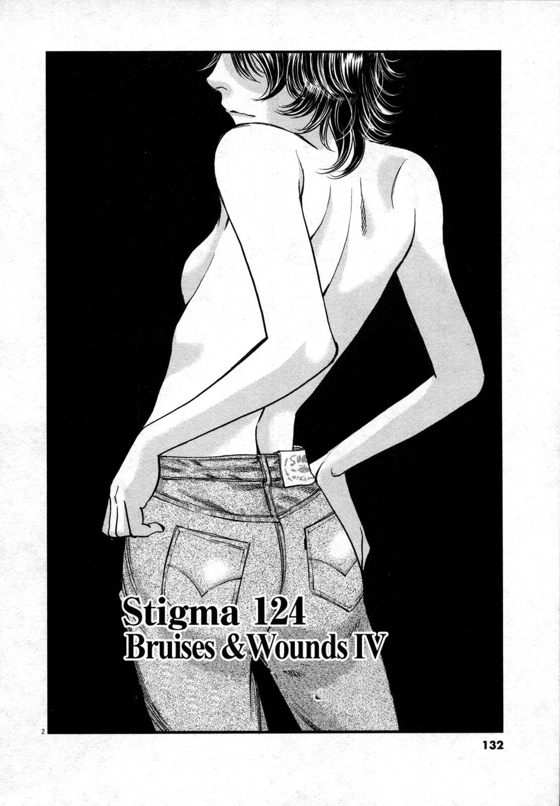 Kono S O, Mi Yo! Vol.12 Chapter 124: Bruises & Wounds Iv - Picture 2